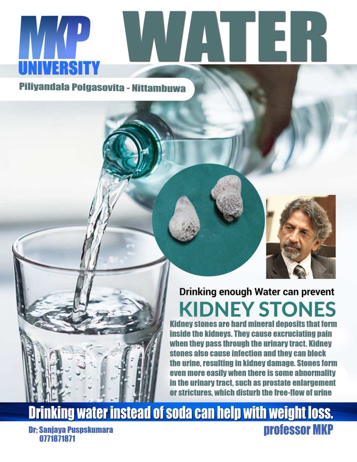 Water vs. Kidney Stones